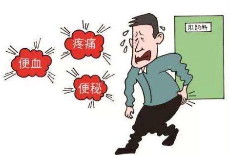 痔疮的类型和治疗方法